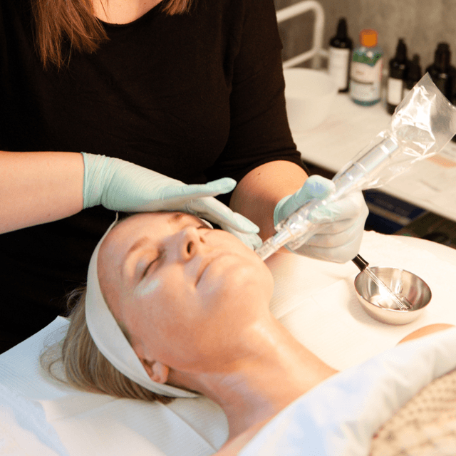 9 Microneedling+ Treatment Package 