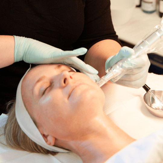 6 Microneedling+ Treatment Package